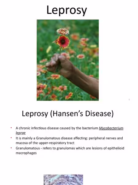 miriam-and-leprosy